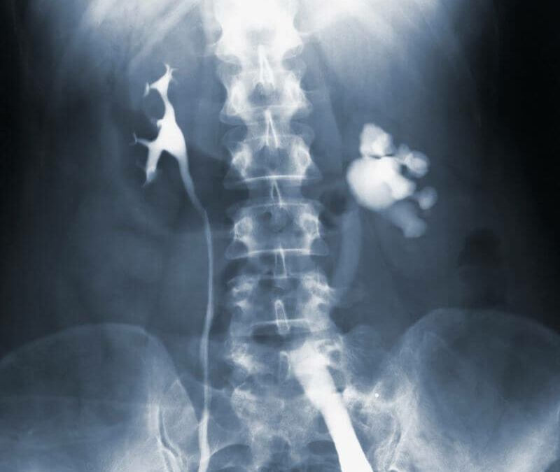 Un ejemplo de una radiografía de columna.